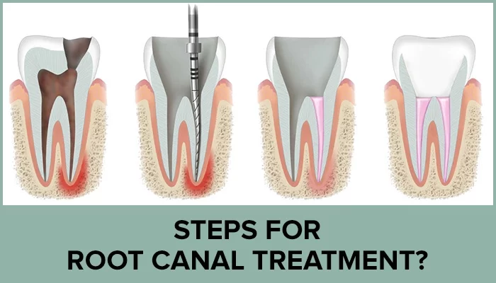 Akemi Dental Specialists | Endodontist Encino CA | Root Canal Encino | Encino Dental Implants Picture 4