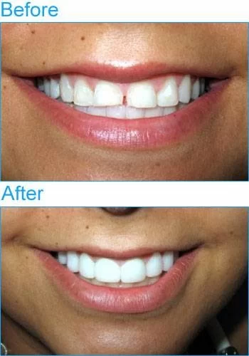 Encino Friendly Dental Center Picture 7