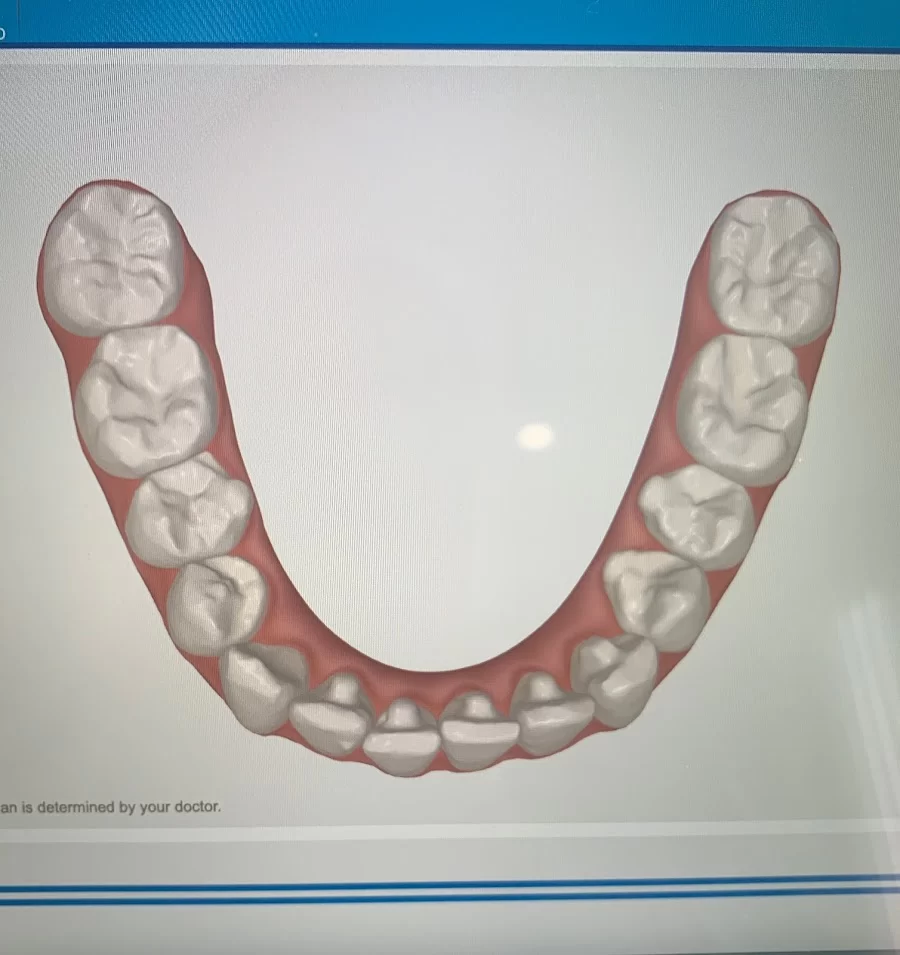 Lasting Impressions Dental Spa | Dentist Encino Picture 6