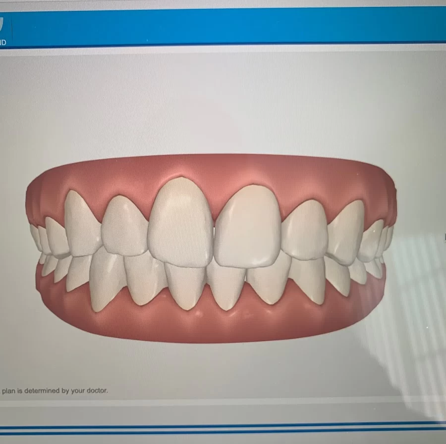 Lasting Impressions Dental Spa | Dentist Encino Picture 4