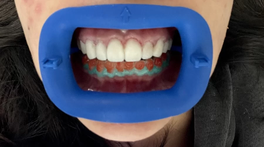 Lasting Impressions Dental Spa | Dentist Encino Picture 2
