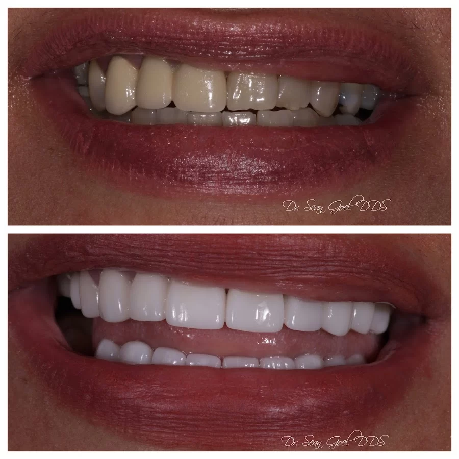 Dr. Soheil Goel, DDS Picture 6