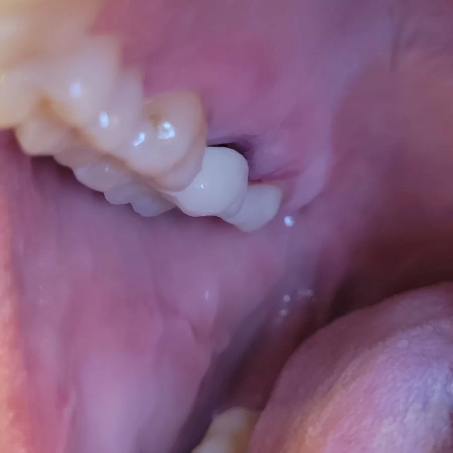 A Belmont Dental Care Picture 1
