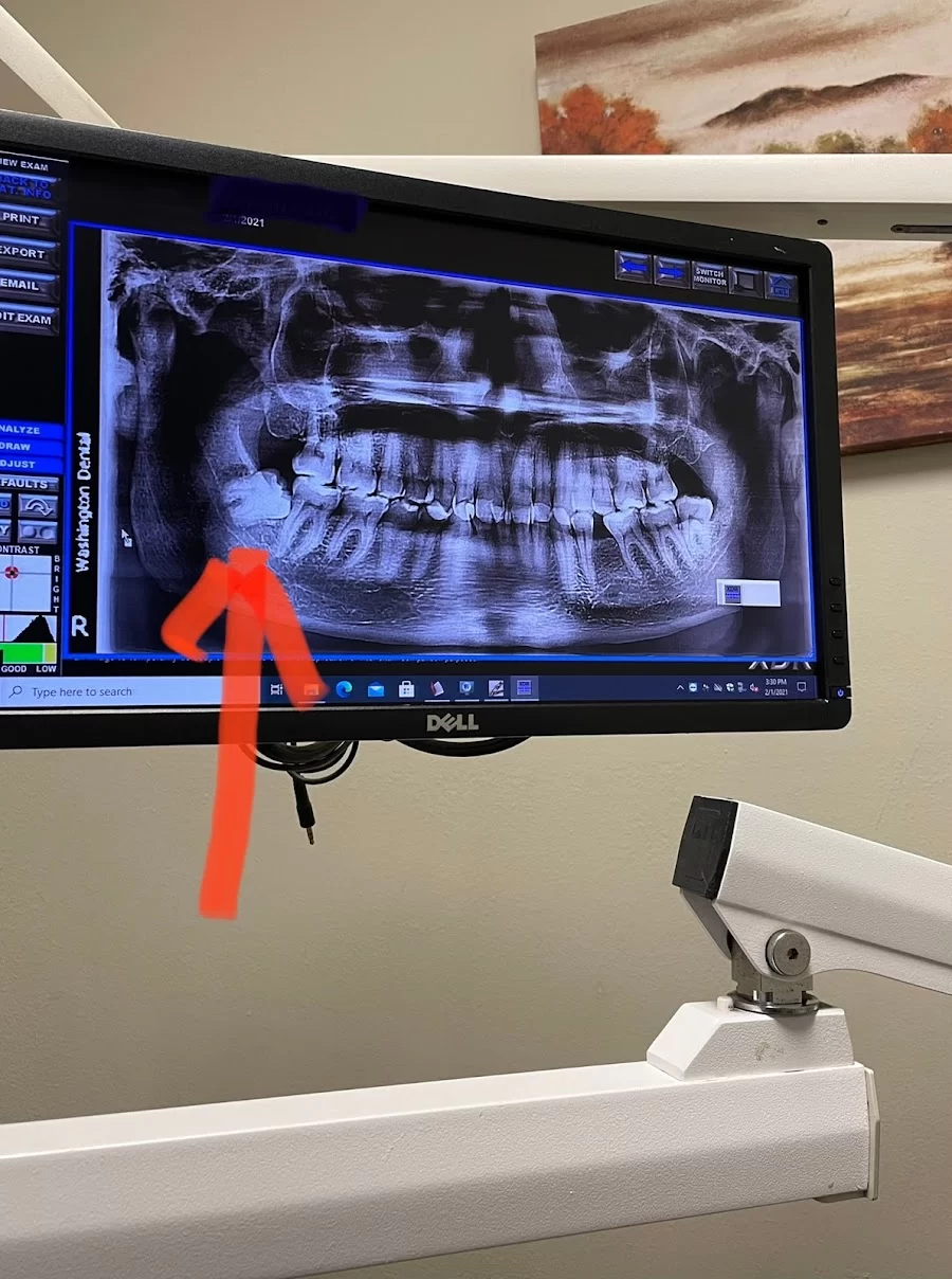 Washington Dental Picture 10