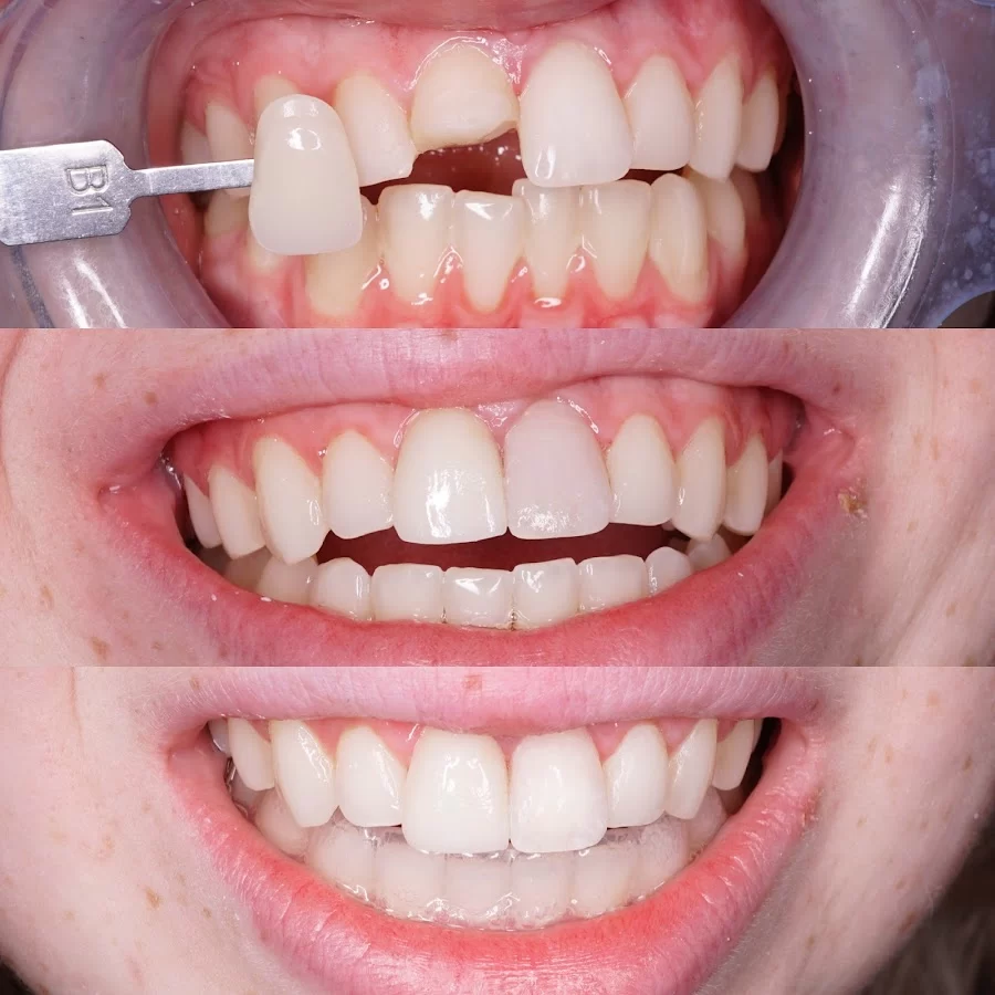 Downtown Dental Picture 1