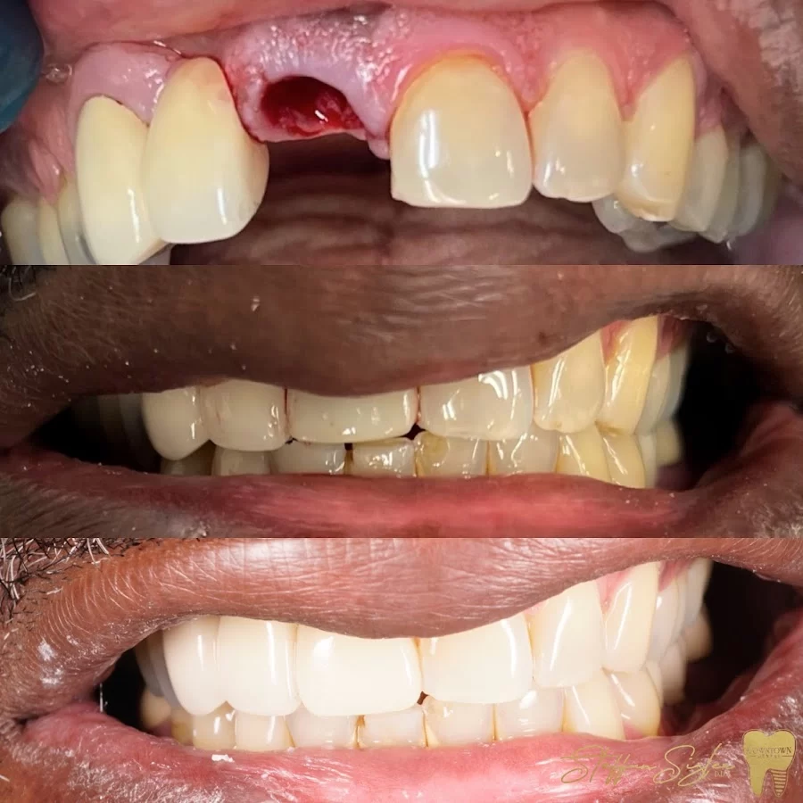 Downtown Dental Picture 6