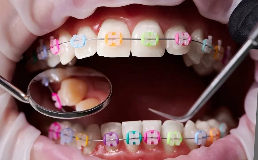 Kendrick Orthodontics Picture 1
