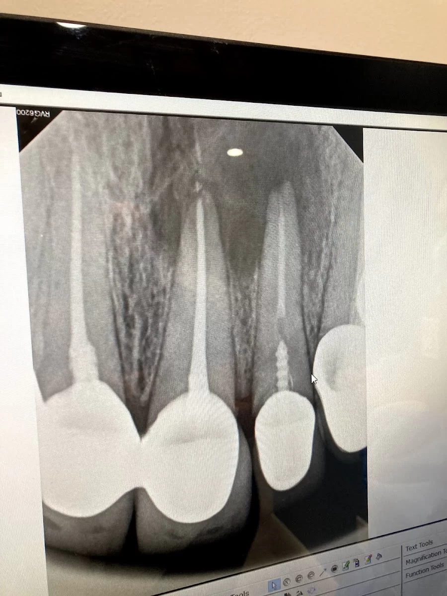 L.A. Smiles Endodontics: Kristina Shagramanova DDS Picture 8