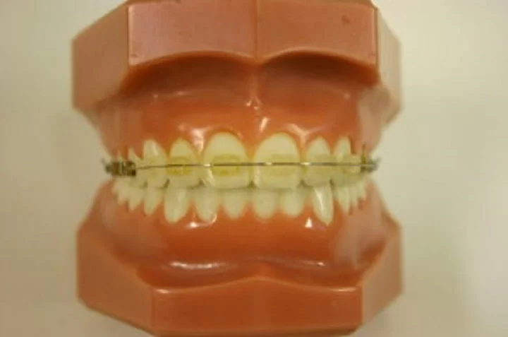 Parkway Dental Care Picture 1