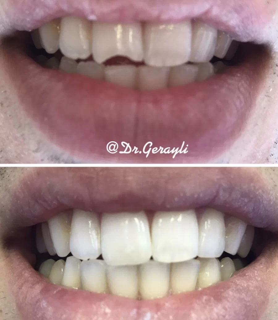 Afsoon Gerayli DDS Picture 7