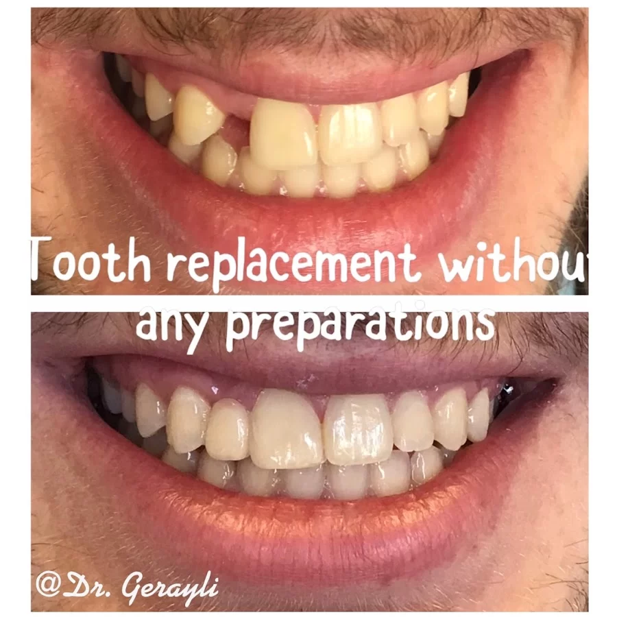 Afsoon Gerayli DDS Picture 8