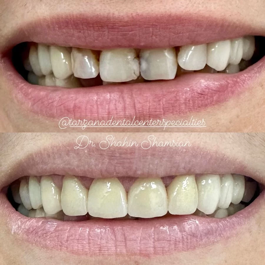 Tarzana Dental Center & Specialties Picture 8