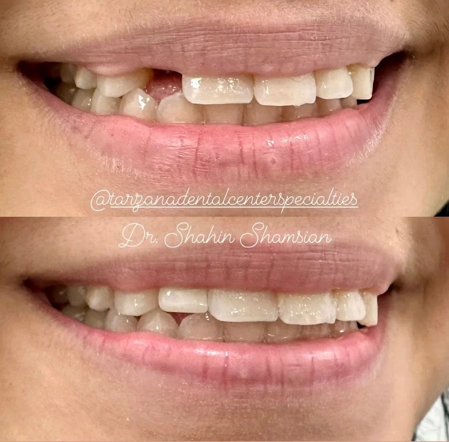 Tarzana Dental Center & Specialties Picture 7