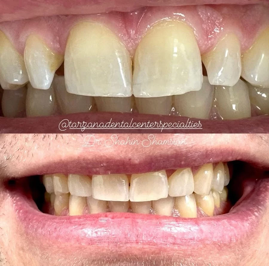 Tarzana Dental Center & Specialties Picture 9