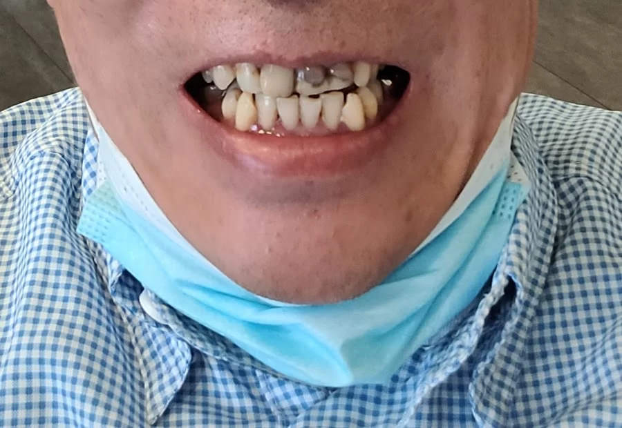 Digital Dental Picture 8