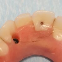 ClearChoice Dental Implant Center ico