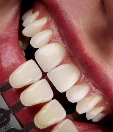 Healthy Smile Dentistry Picture 6