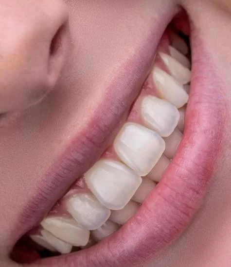 Healthy Smile Dentistry Picture 7