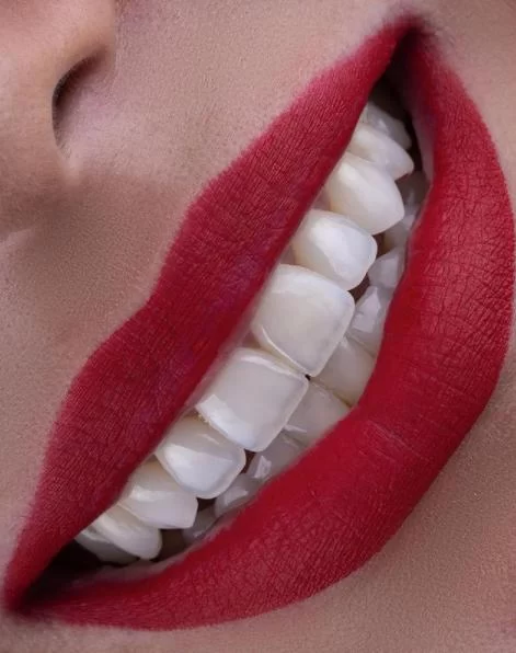 Healthy Smile Dentistry Picture 8