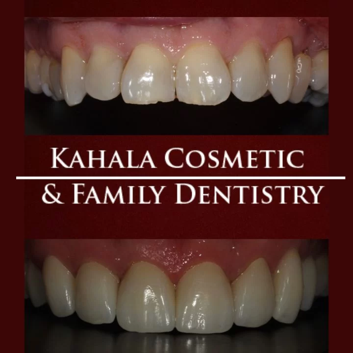 Kahala Modern Dentistry Picture 2