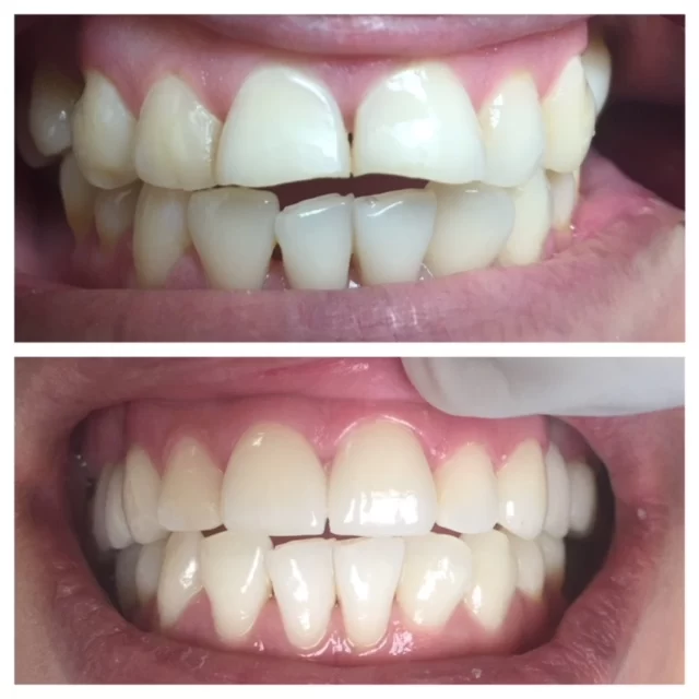 PhD Dental of Pico Rivera, Adults, Kids & Implants Picture 3