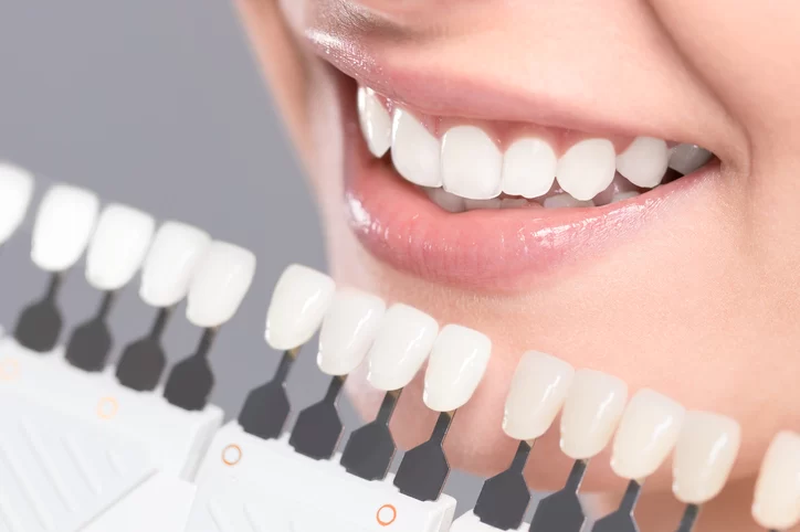Desert Dental Picture 4