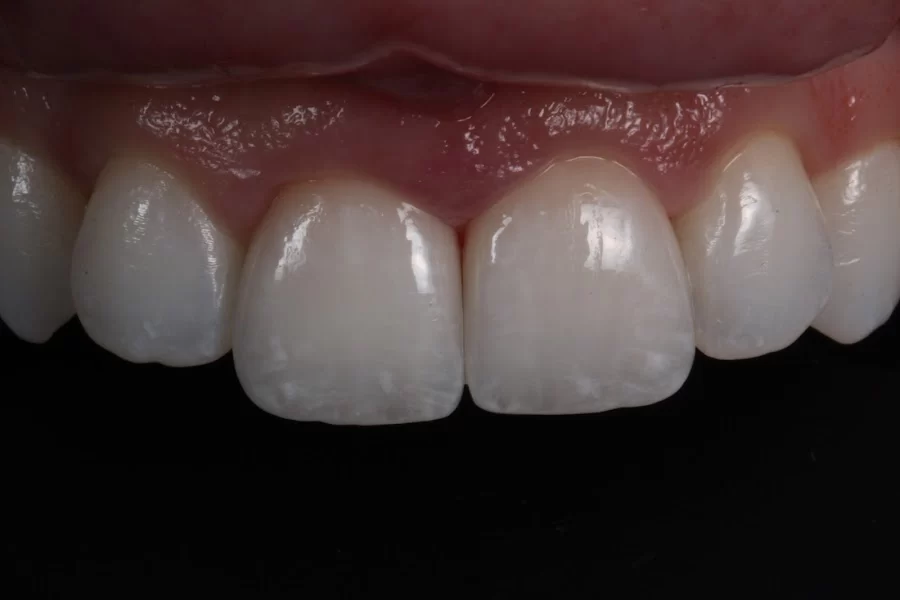 Burbank Dental Lab Picture 1