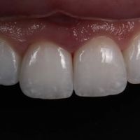 Burbank Dental Lab ico