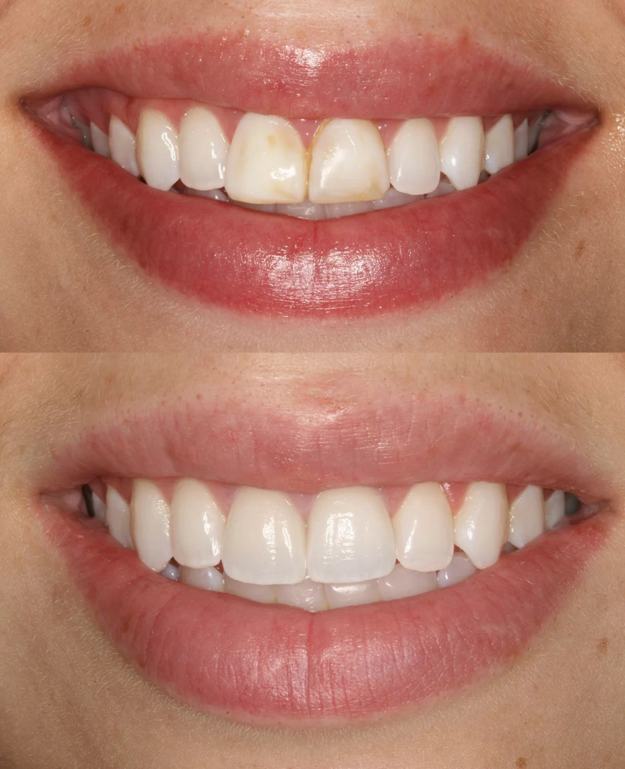 Burbank Dental Lab Picture 9