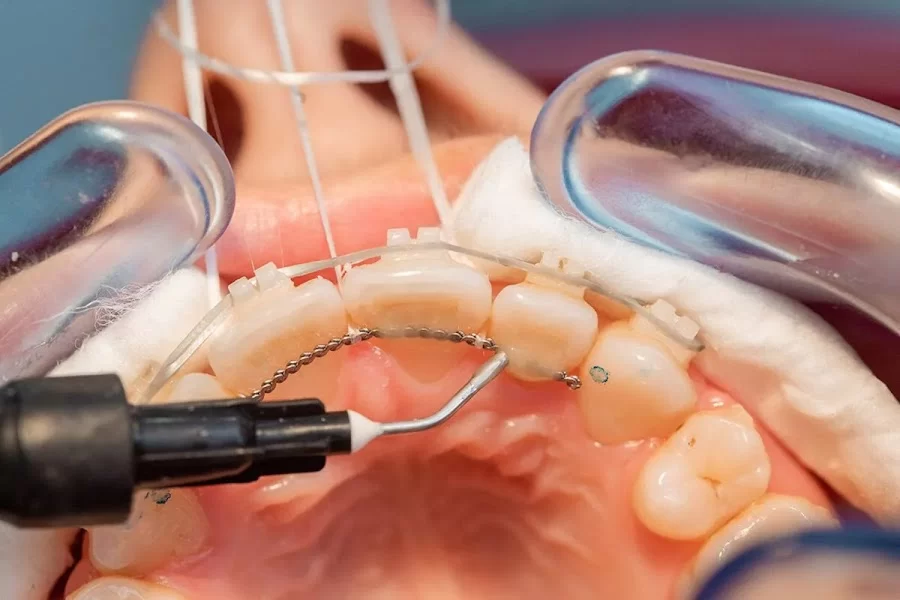 Burbank Dental Lab Picture 7
