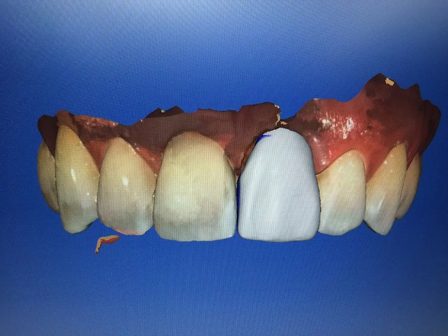 Crown Heights Dentistry Picture 8