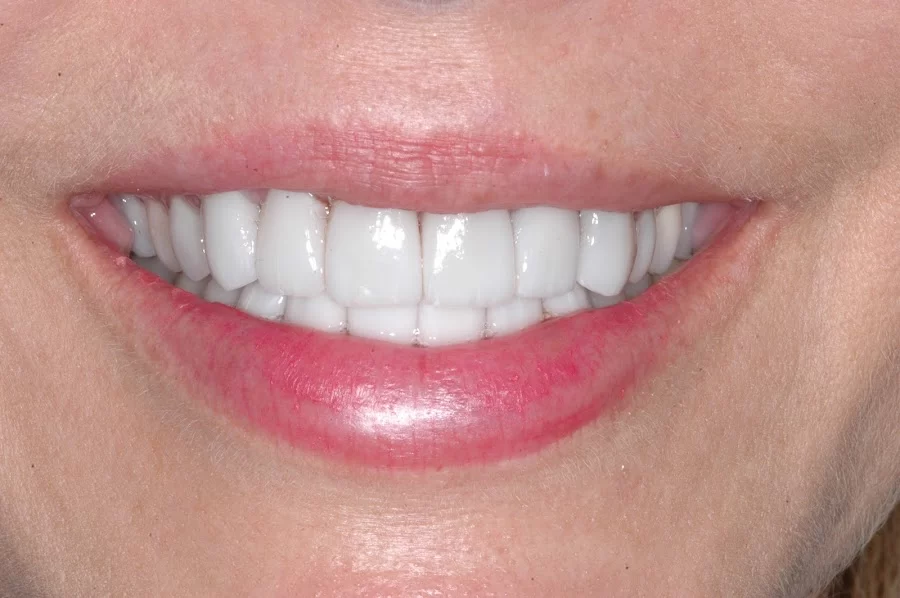 Crown Heights Dentistry Picture 7