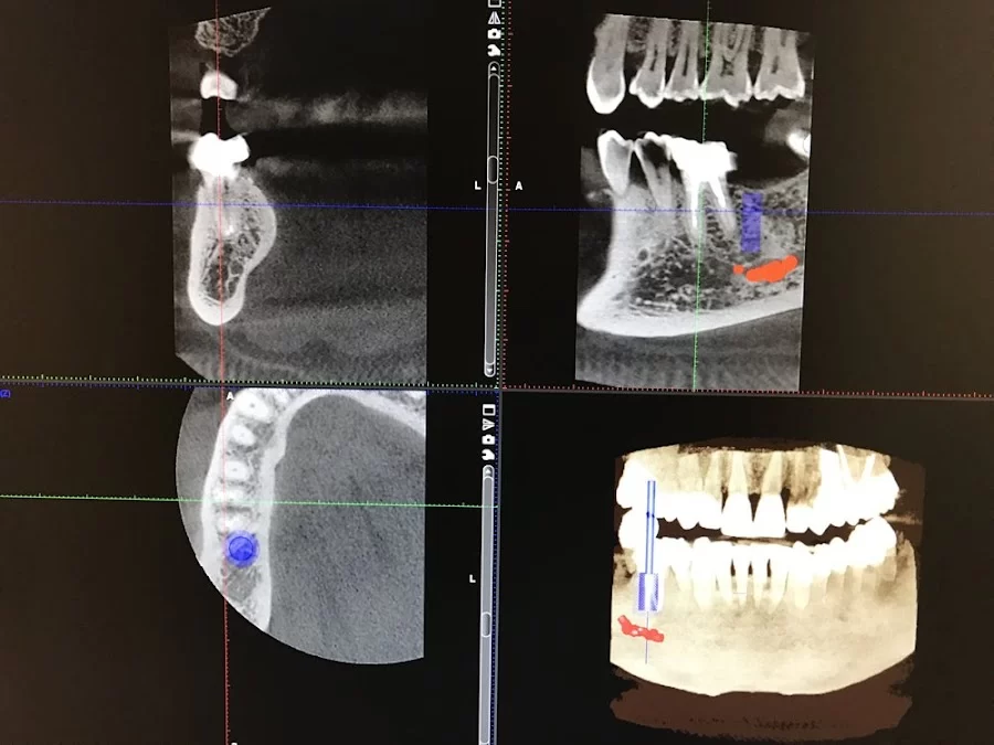 Saryan Dental Picture 5