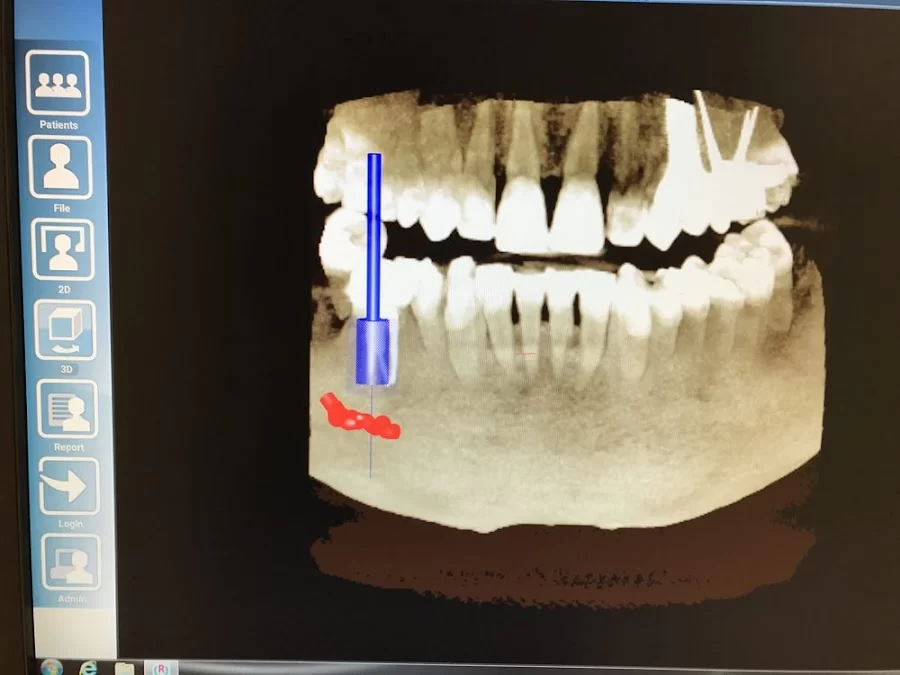 Saryan Dental Picture 3