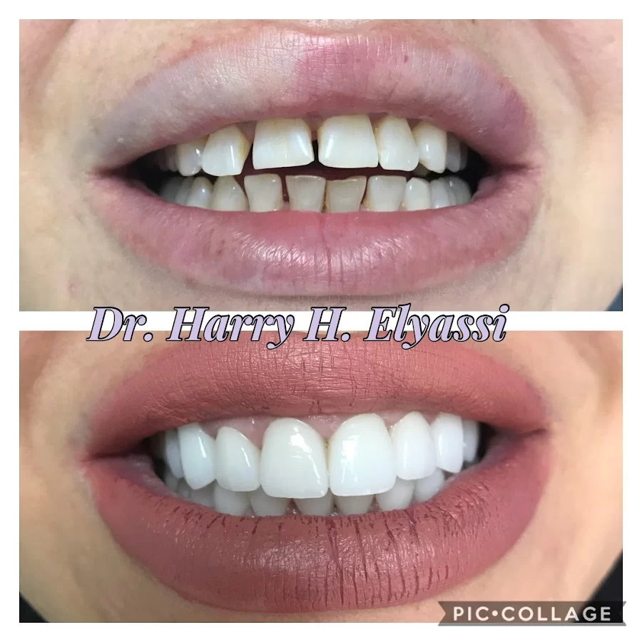 Atrium Dental - Dr. Harry H. Elyassi, D.M.D., INC. Picture 9