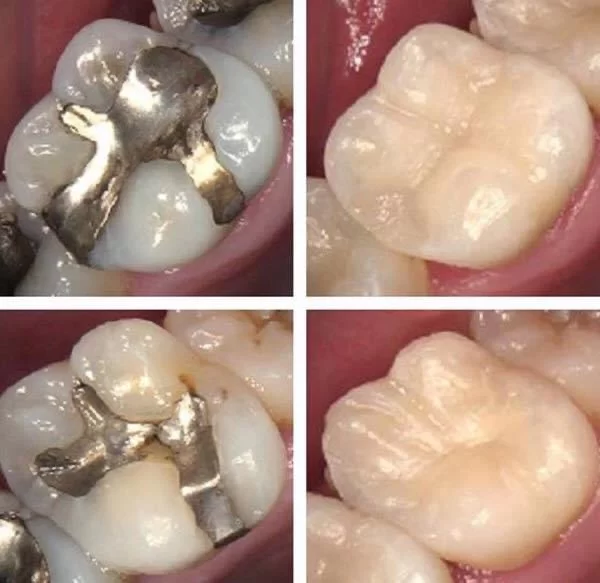 Atrium Dental - Dr. Harry H. Elyassi, D.M.D., INC. Picture 5
