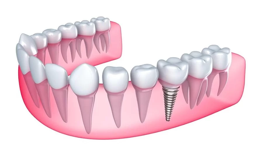 Fair Oaks Family Dental Picture 1