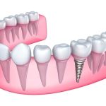 Fair Oaks Family Dental