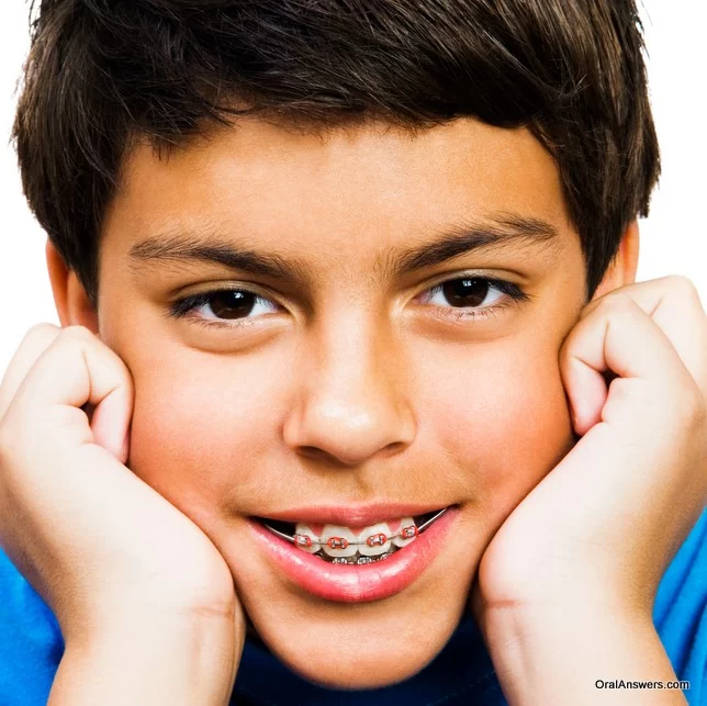 EMBRACE ORTHODONTICS Picture 5