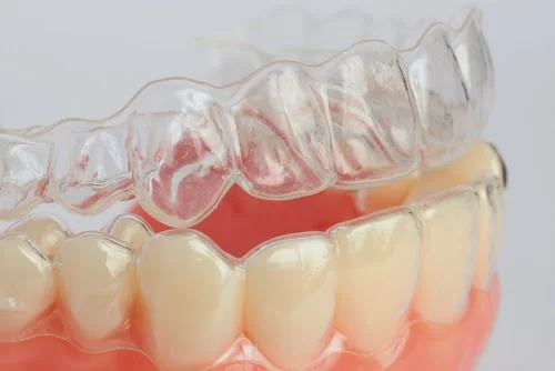 Smile & Beyond: Dr. Audrey Yoon Orthodontics Picture 2