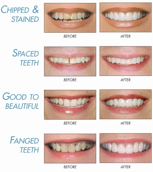 Healthy Life Dental Picture 2