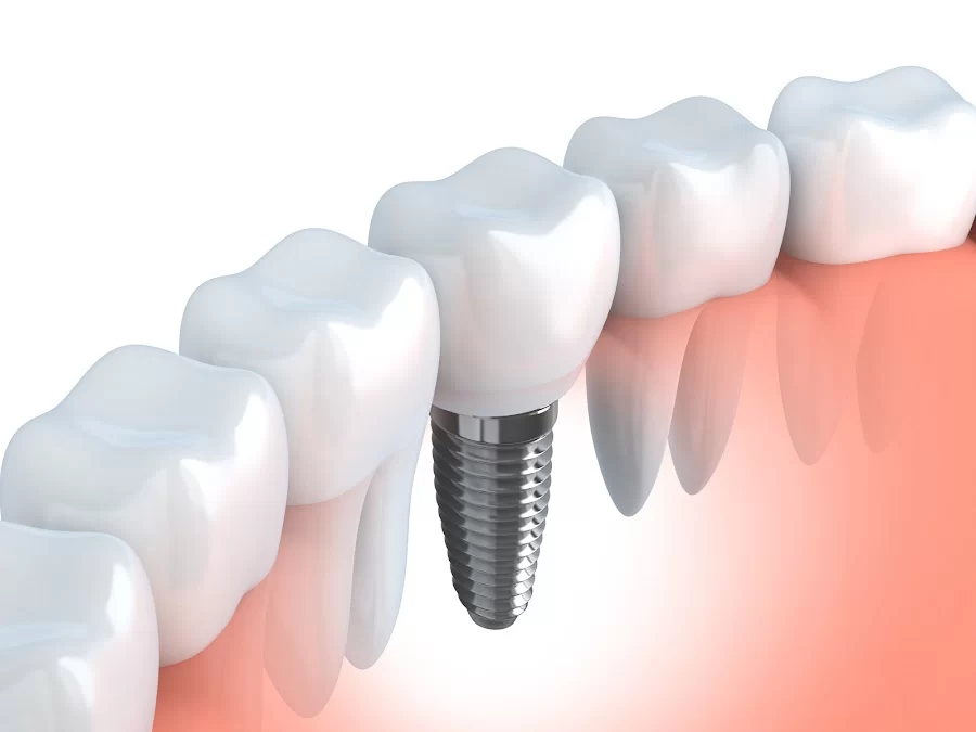 Lake Eola Dental Picture 1
