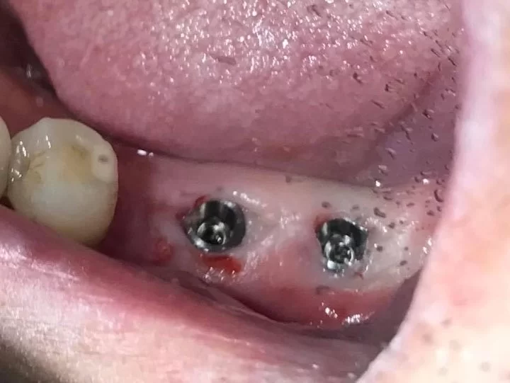 Able Dental - Gaeun Lee DDS Inc. Picture 2