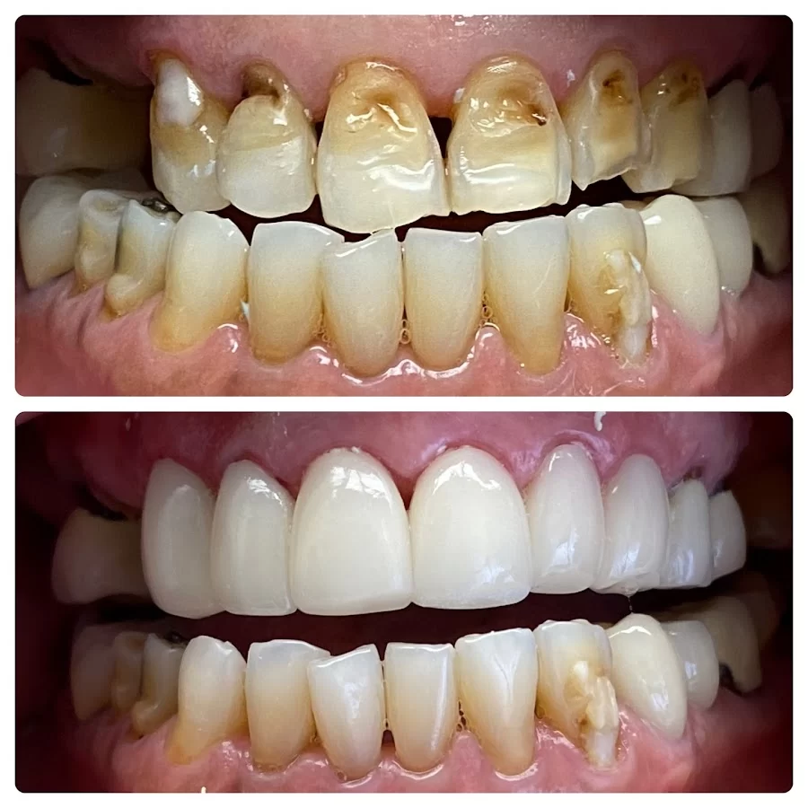 Foothill Dental Care: Jean Lee, DDS Picture 7