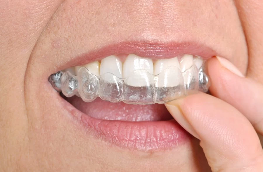 Foothill Dental Care: Jean Lee, DDS Picture 5