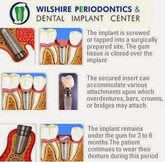 Wilshire Periodontics & Dental Picture 3