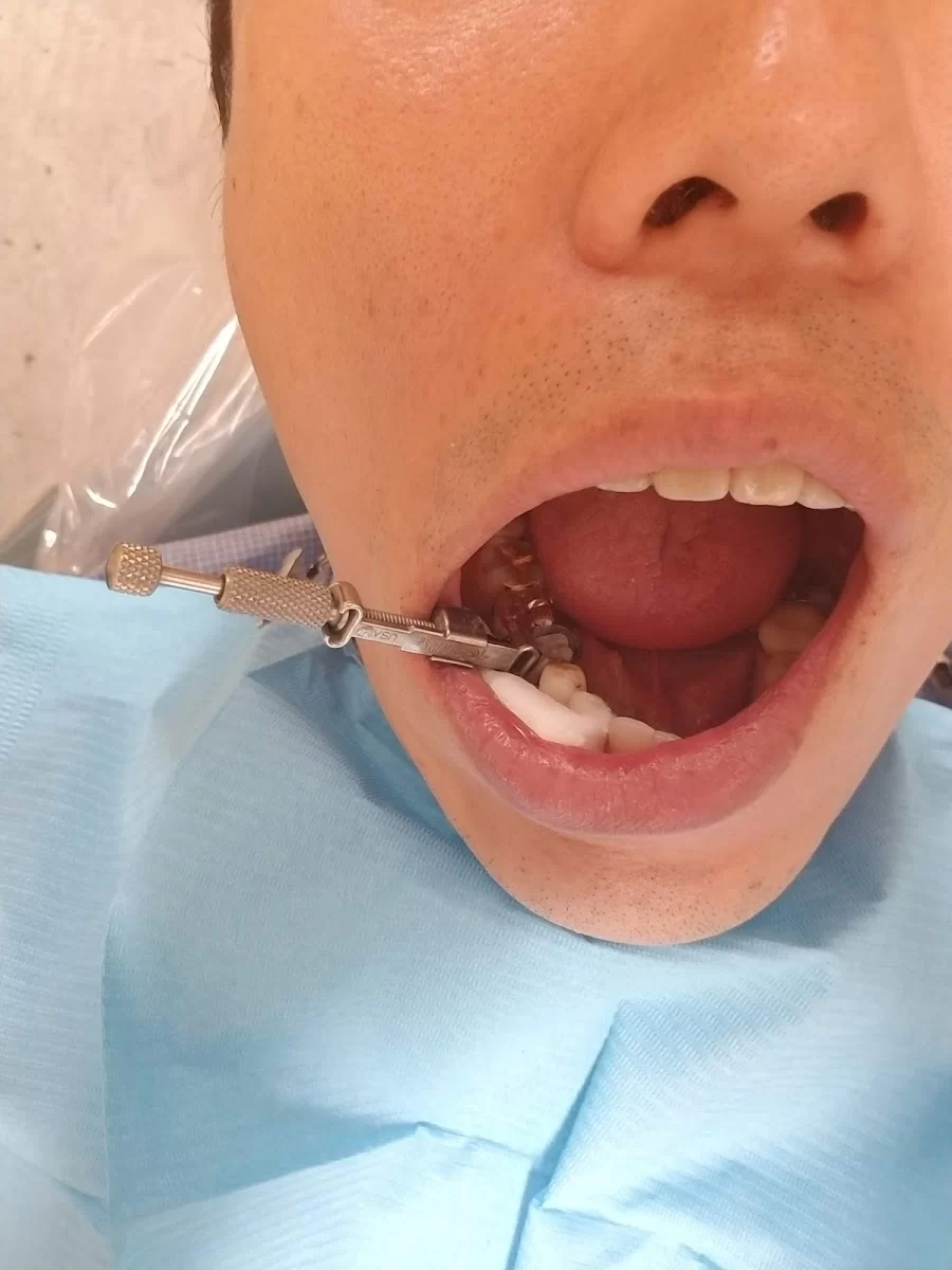 명치과 IMPLANT Dental office Picture 10