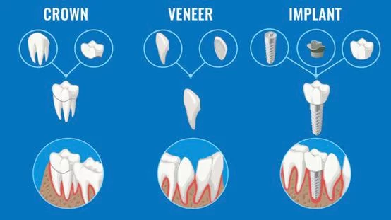 명치과 IMPLANT Dental office Picture 4