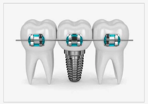 명치과 IMPLANT Dental office Picture 5