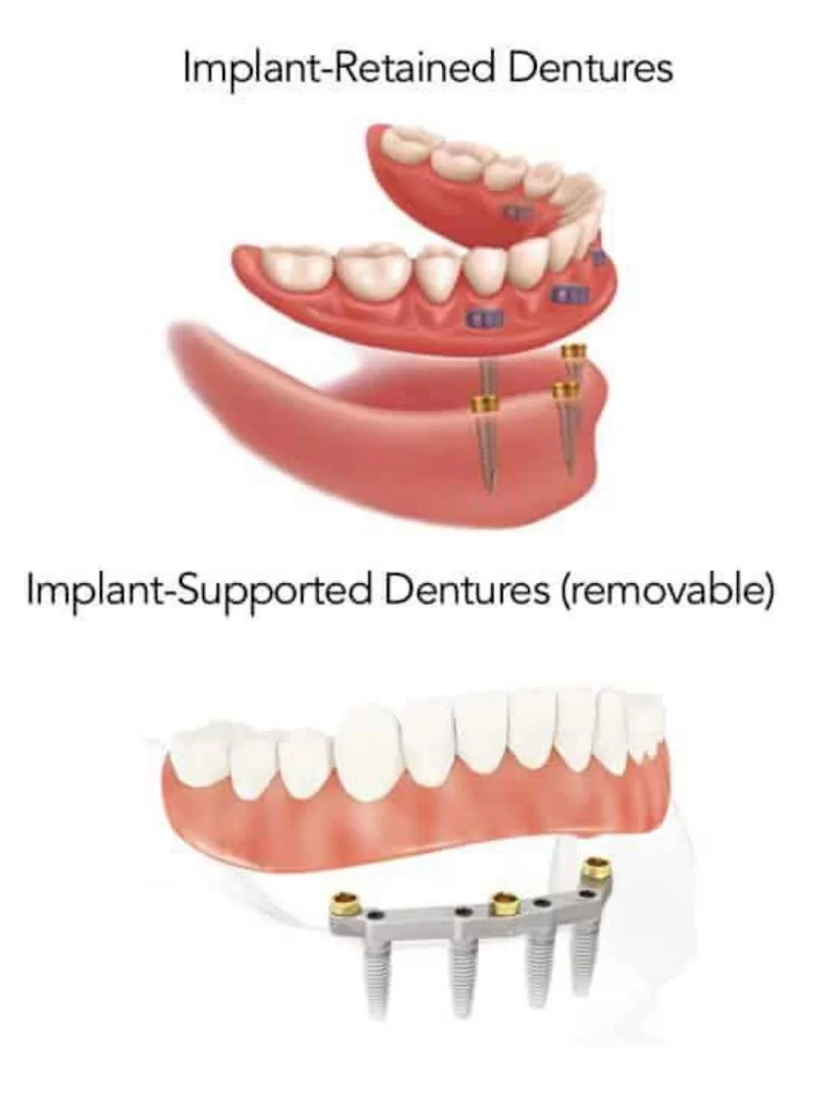 명치과 IMPLANT Dental office Picture 6